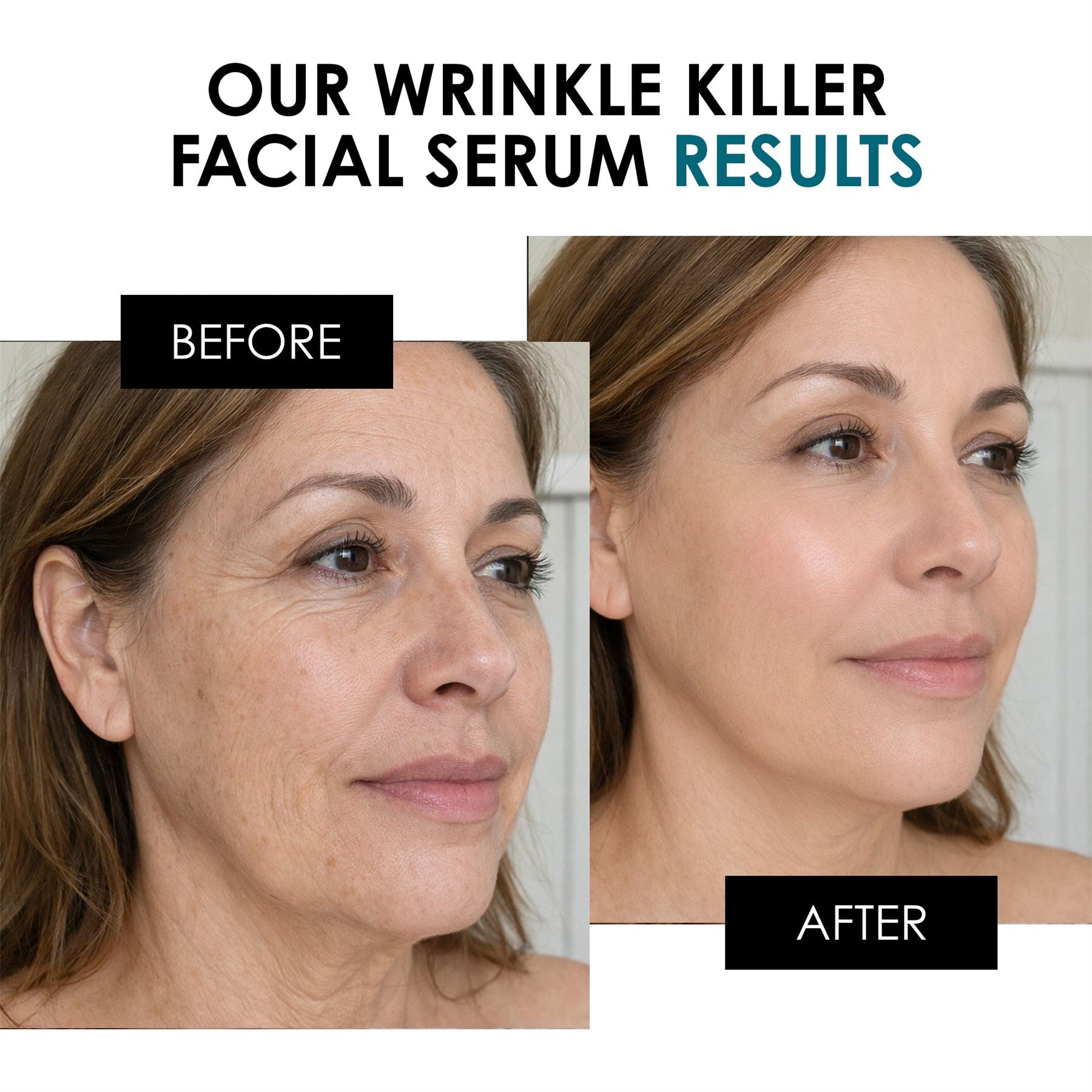 Faltenbekämpfendes Gesichtsserum 30 ml