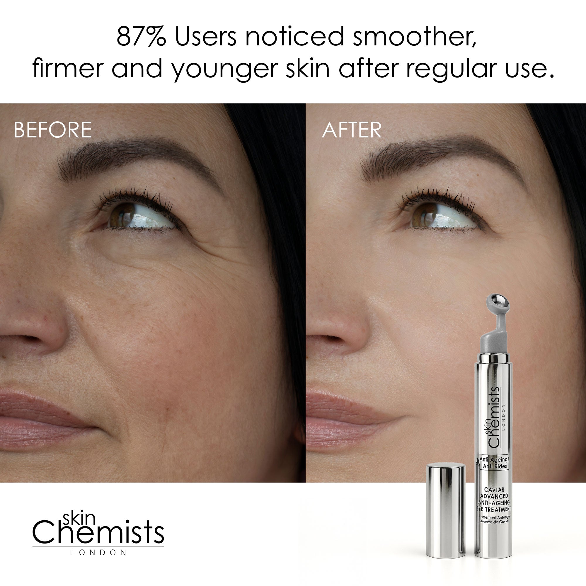 Caviar Advanced Anti-Ageing Eye Treatment 15ml