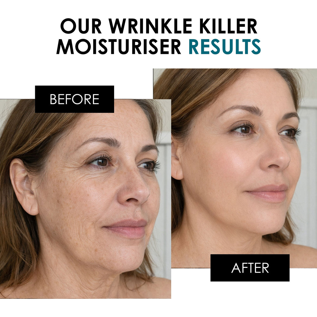 SC Wrinkle Killer Night Moisturiser 50ml - skinChemists