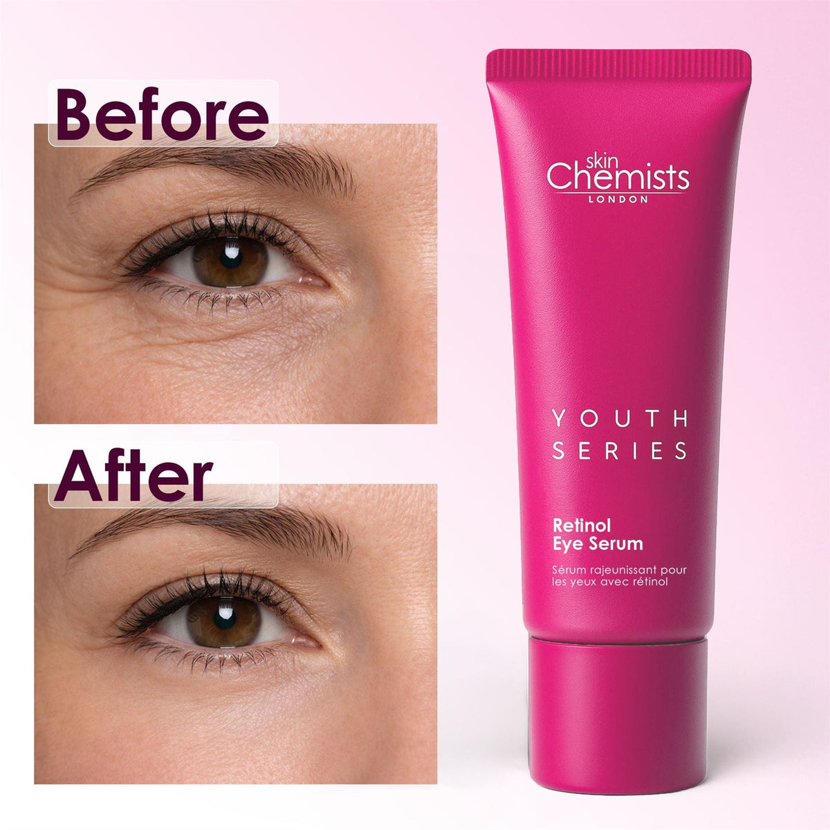 Retinol Eye Serum 15ml - skinChemists